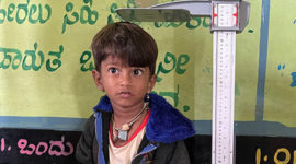 Kalpaka - Malnutrition child